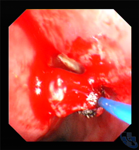 image005.png
