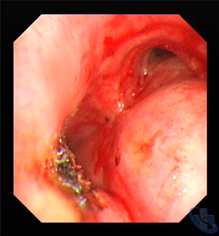 image007.png