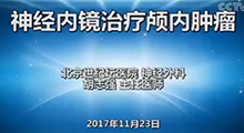 胡志强：神经内镜治疗颅内肿瘤